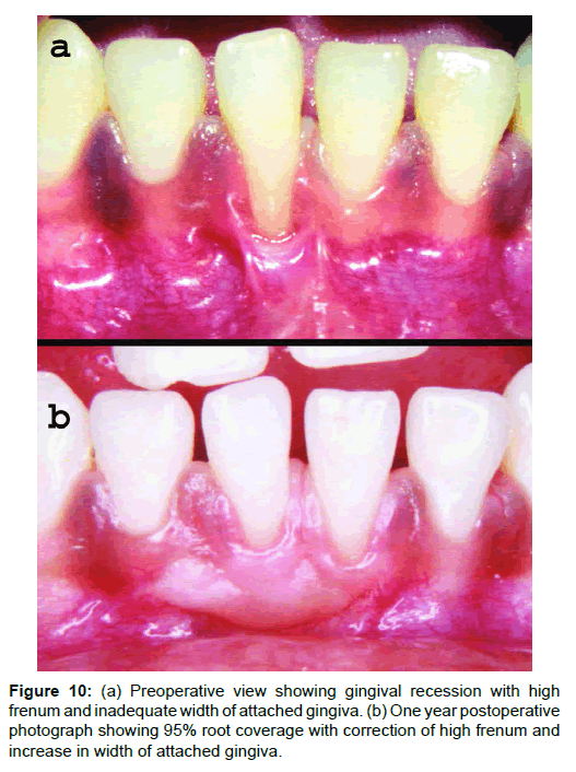 Medicine-Dental-Preoperative-view