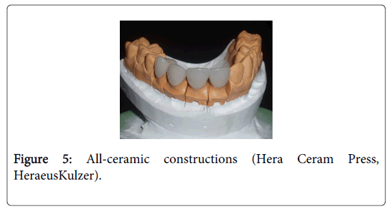 Medicine-Dental-Science-All-ceramic-constructions