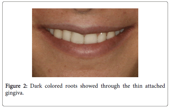 Medicine-Dental-Science-Dark-colored-roots-showed