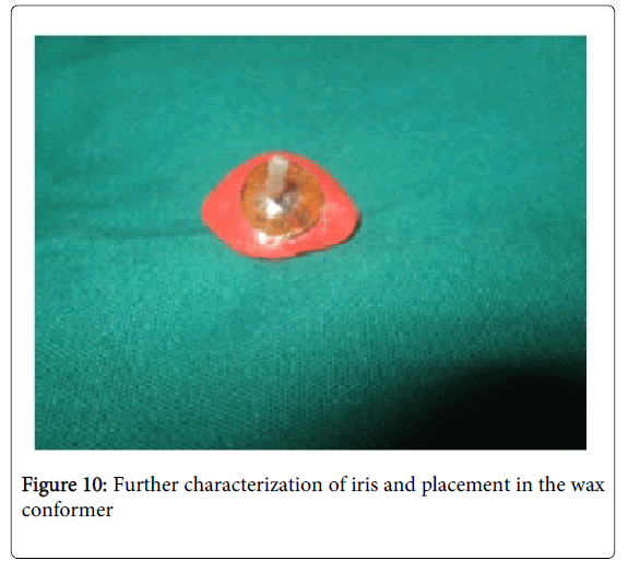 Medicine-Dental-Science-Further-characterization-iris-placement