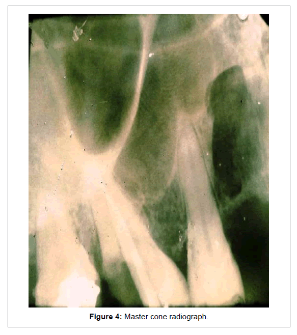 Medicine-Dental-Science-Master-cone-radiograph