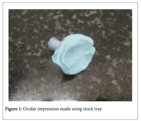 Medicine-Dental-Science-Ocular-impression-made-using-stock-tray