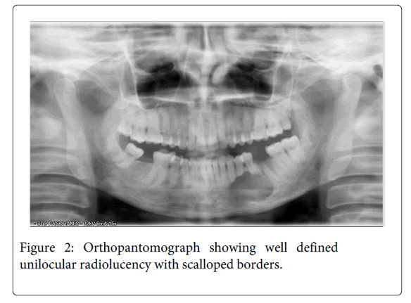 Medicine-Dental-Science-Orthopantomograph-showing-well-defined