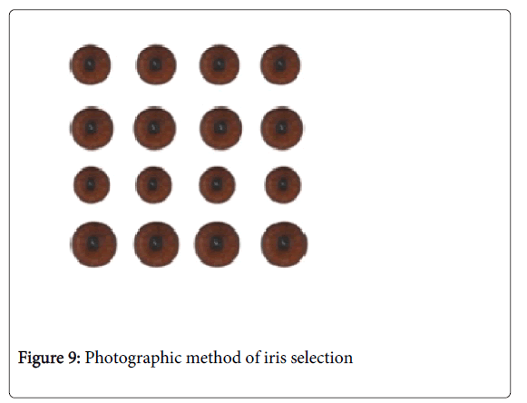Medicine-Dental-Science-Photographic-method-iris-selection