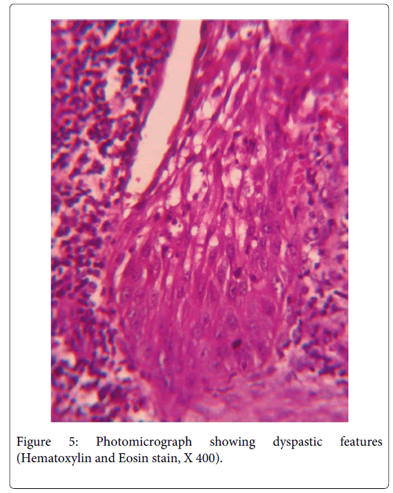 Medicine-Dental-Science-Photomicrograph-showing-dyspastic-features