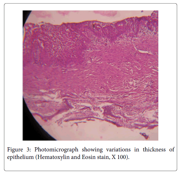 Medicine-Dental-Science-Photomicrograph-showing-variations-thickness