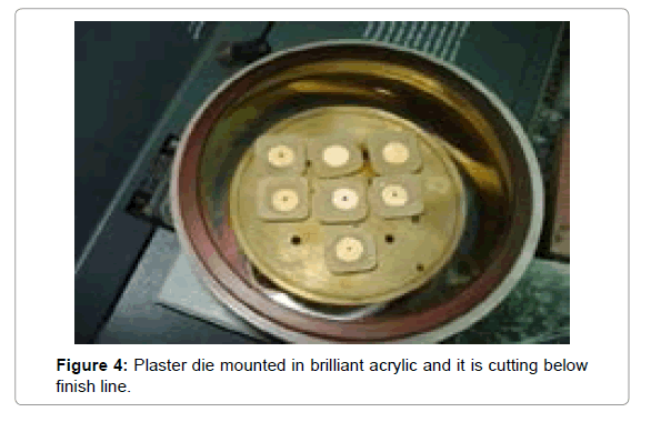 Medicine-Dental-Science-Plaster-die-mounted-brilliant-acrylic