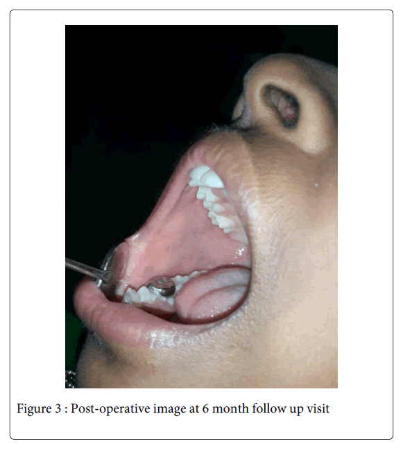 Medicine-Dental-Science-Post-operative-image-6-month-visit