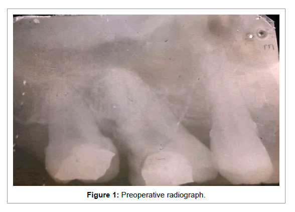 Medicine-Dental-Science-Preoperative-radiograph