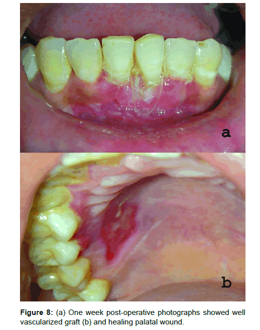 Medicine-Dental-post-operative