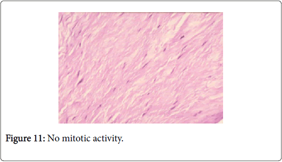 Otolaryngology-mitotic-activity