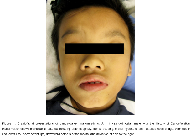 Pediatric-Dental-Care-Craniofacial-presentations