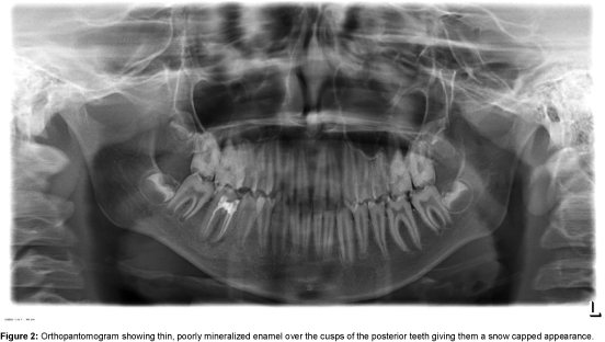 Pediatric-Dental-Care-Orthopantomogram
