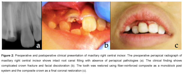 Pediatric-Dental-Care-Preoperative-postoperative