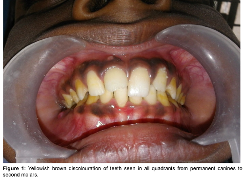 Pediatric-Dental-Care-Yellowish-brown