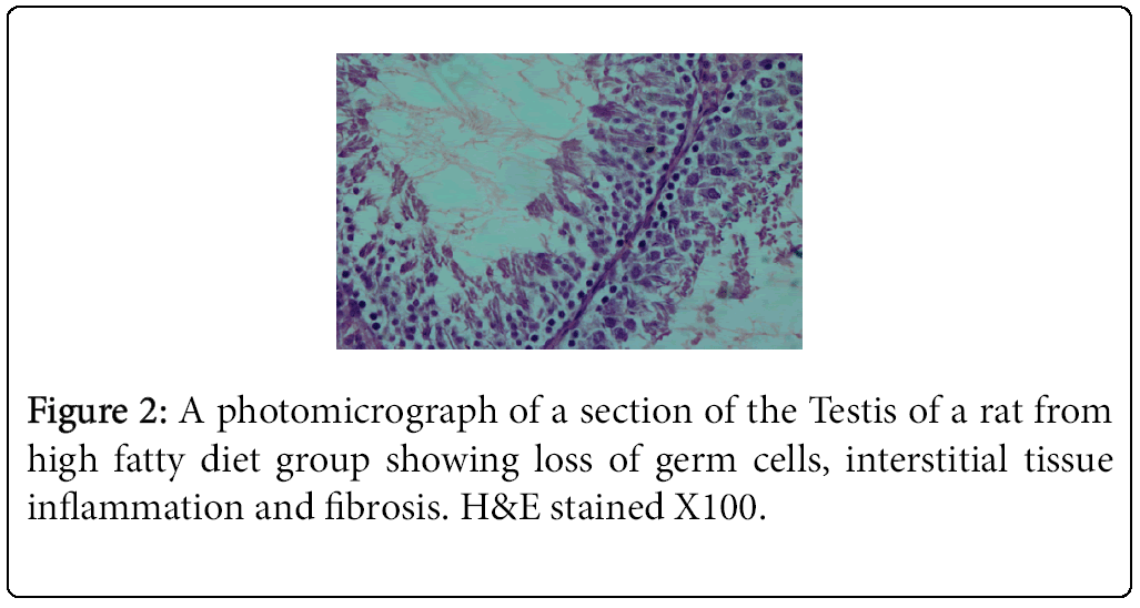 Weight-Loss-photomicrograph-section-Testis-rat-fatty-diet