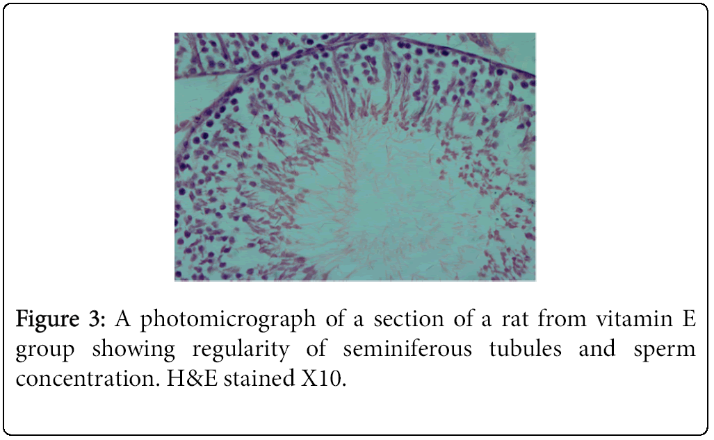 Weight-Loss-photomicrograph-section-Testis-rat-vitamin-E