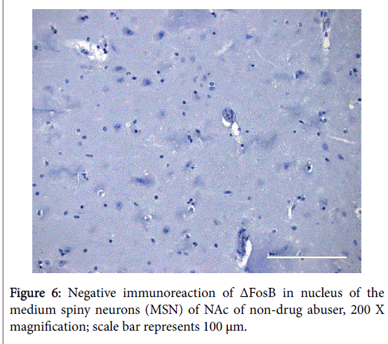 addiction-research-Negative-immunoreaction