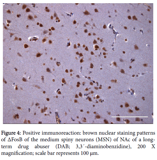 addiction-research-Positive-immunoreaction