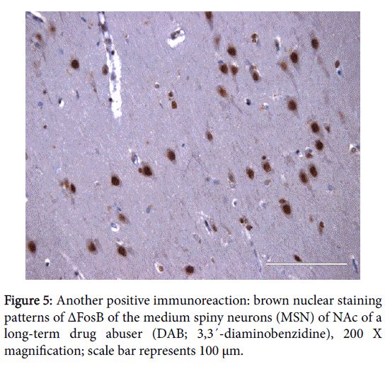 addiction-research-nuclear-staining