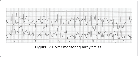 addiction-research-experimental-Holter-monitoring