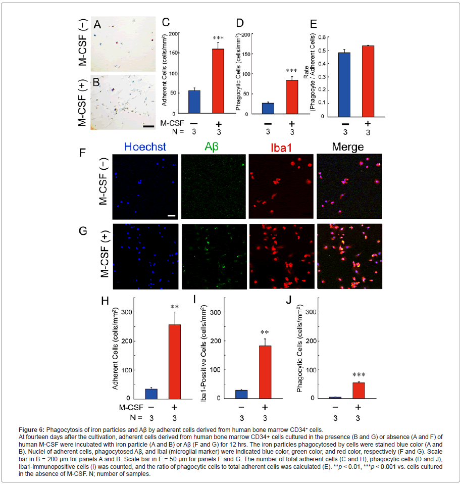 addiction-research-experimental-bone-marrow