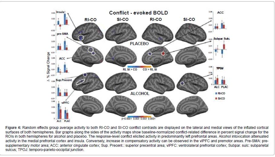 addiction-research-experimental-cortex-insula