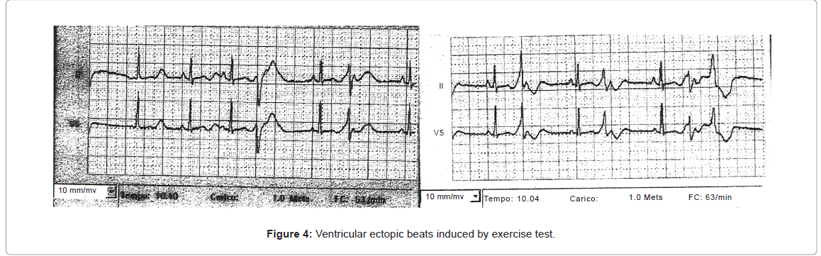 addiction-research-experimental-exercise-test