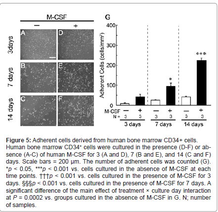 addiction-research-experimental-human-bone