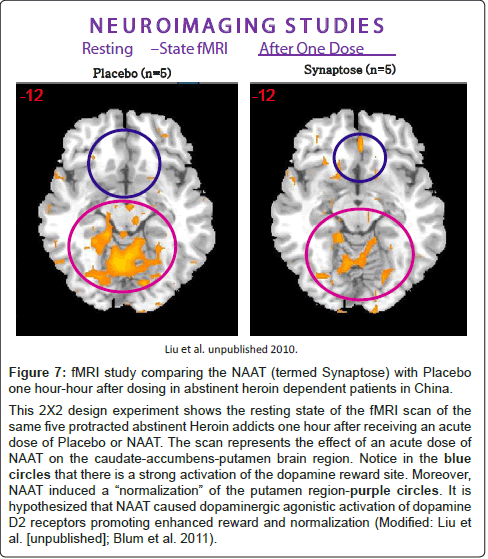 addiction-research-experimental-termed-Synaptose