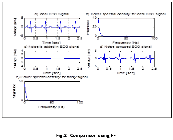 ecg signal using wavelet matlab code ecg signal using wavelet matlab code