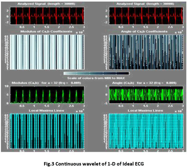 advance-innovations-thoughts-Continuous-wavelet-1-D