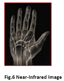 advance-innovations-thoughts-Near-Infrared-Image