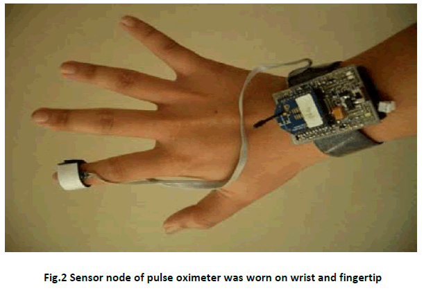 advance-innovations-thoughts-ideas-pulse-oximeter