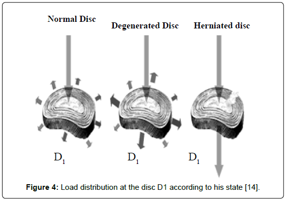 advances-cancer-prevention-Load-distribution