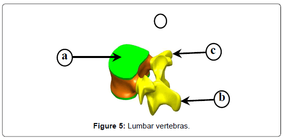 advances-cancer-prevention-Lumbar-vertebras