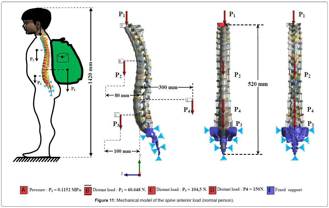 advances-cancer-prevention-Mechanical-model