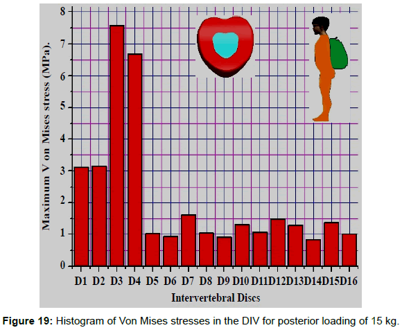 advances-cancer-prevention-Mises-stresses