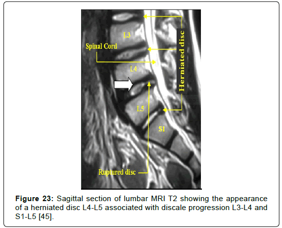 advances-cancer-prevention-Sagittal-section
