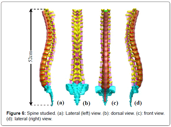 advances-cancer-prevention-Spine-studied
