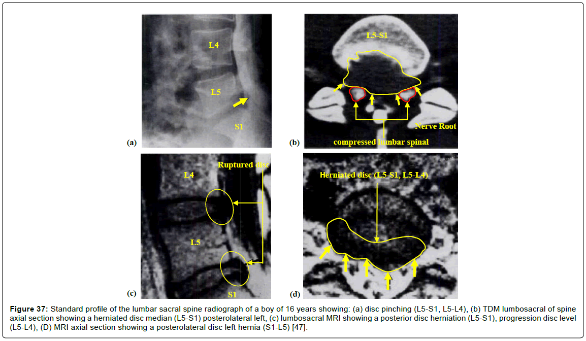 advances-cancer-prevention-Standard-profile