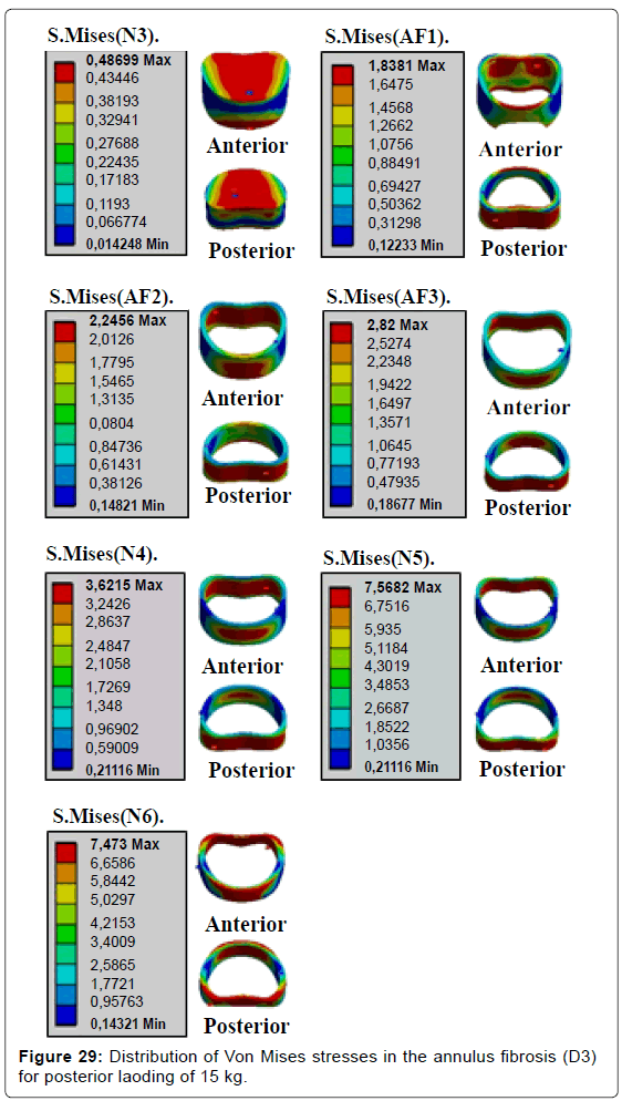 advances-cancer-prevention-annulus-fibrosis