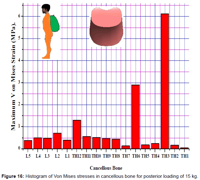advances-cancer-prevention-cancellous-bone