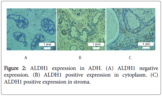 advances-cancer-prevention-expression-ADH