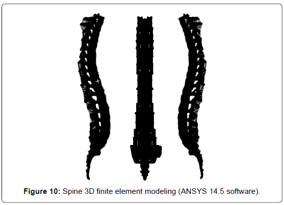 advances-cancer-prevention-finite-element-modeling