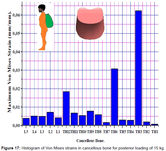 advances-cancer-prevention-posterior-loading