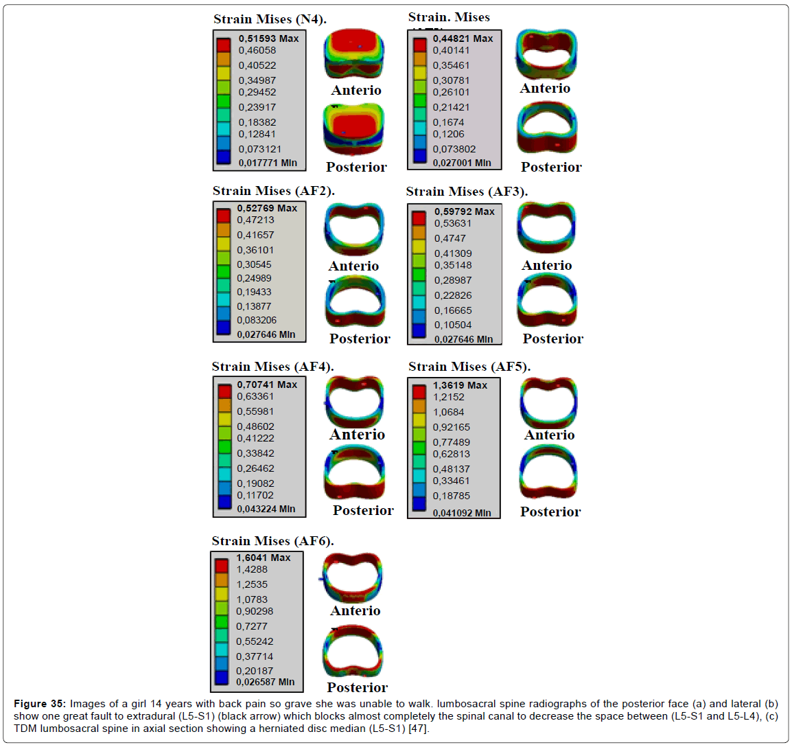 advances-cancer-prevention-spine-radiographs