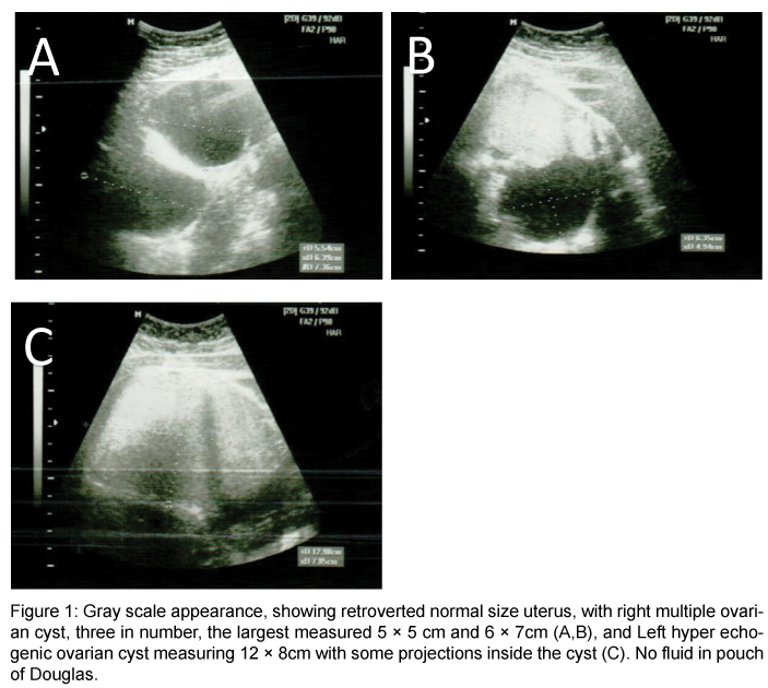 advances-oncology-research-and-treatments-Gray-scale