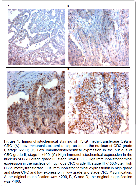 advances-oncology-research-immunohistochemical-h3k9