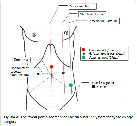 advancesroboticsautomationthetrocarportplacement